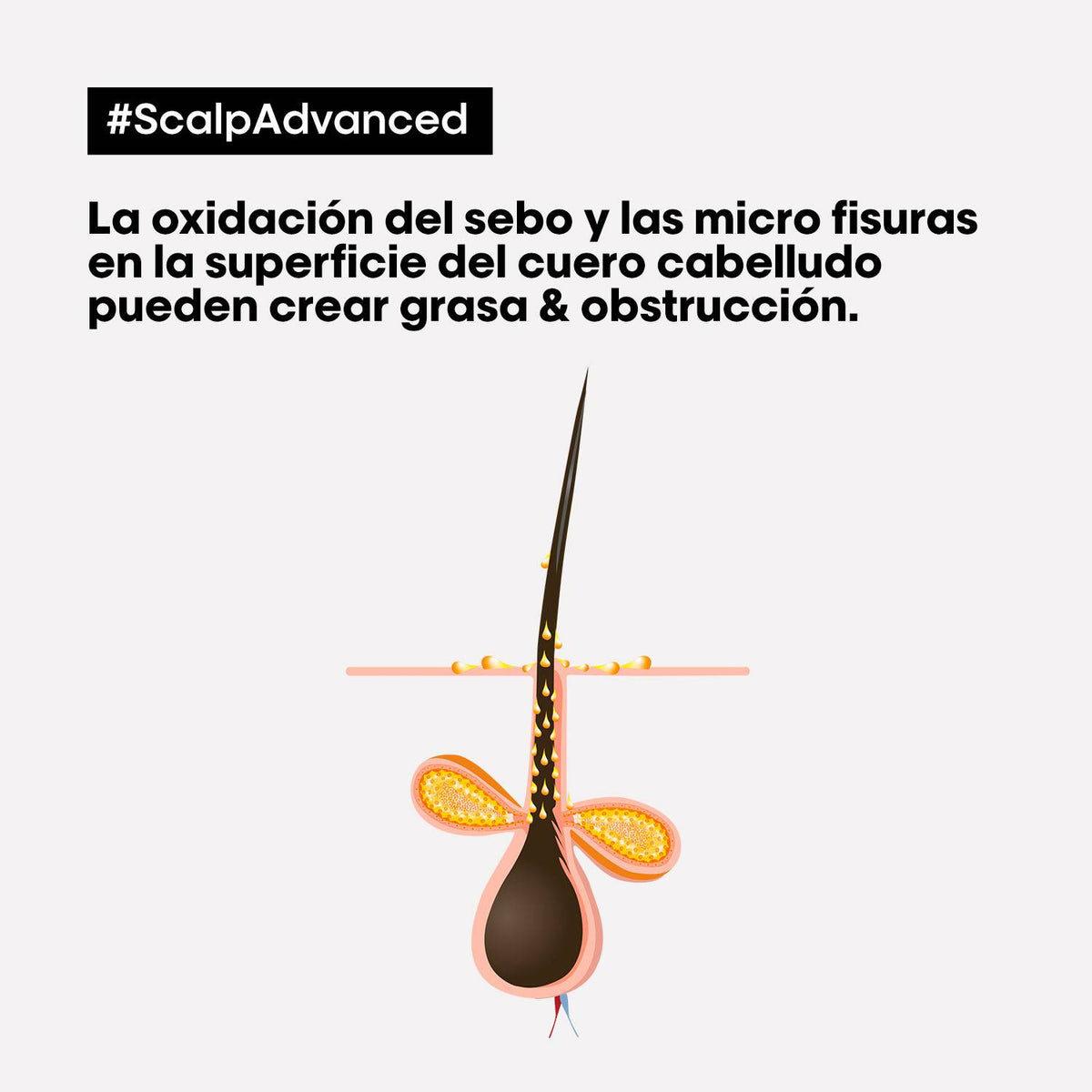 L'Oreal Pro  | Shampoo Scalp Advanced Anti grasa Loreal professionnel 300 ml