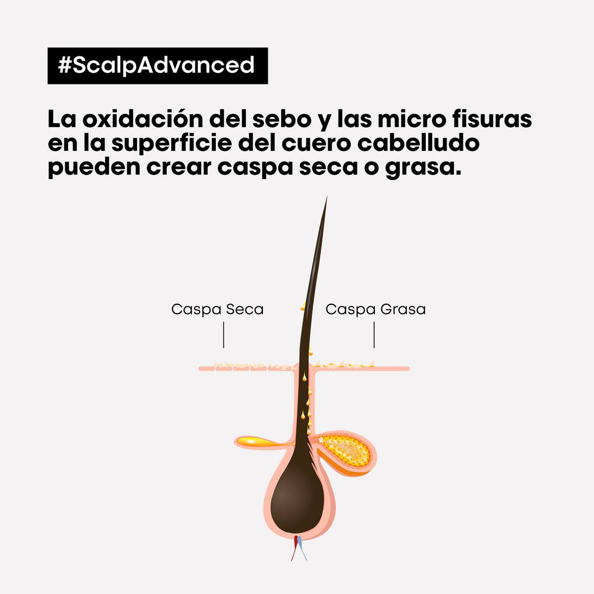 L'Oreal Pro  | Shampoo Scalp Advanced Anti caspa 300 Loreal professionnel ml