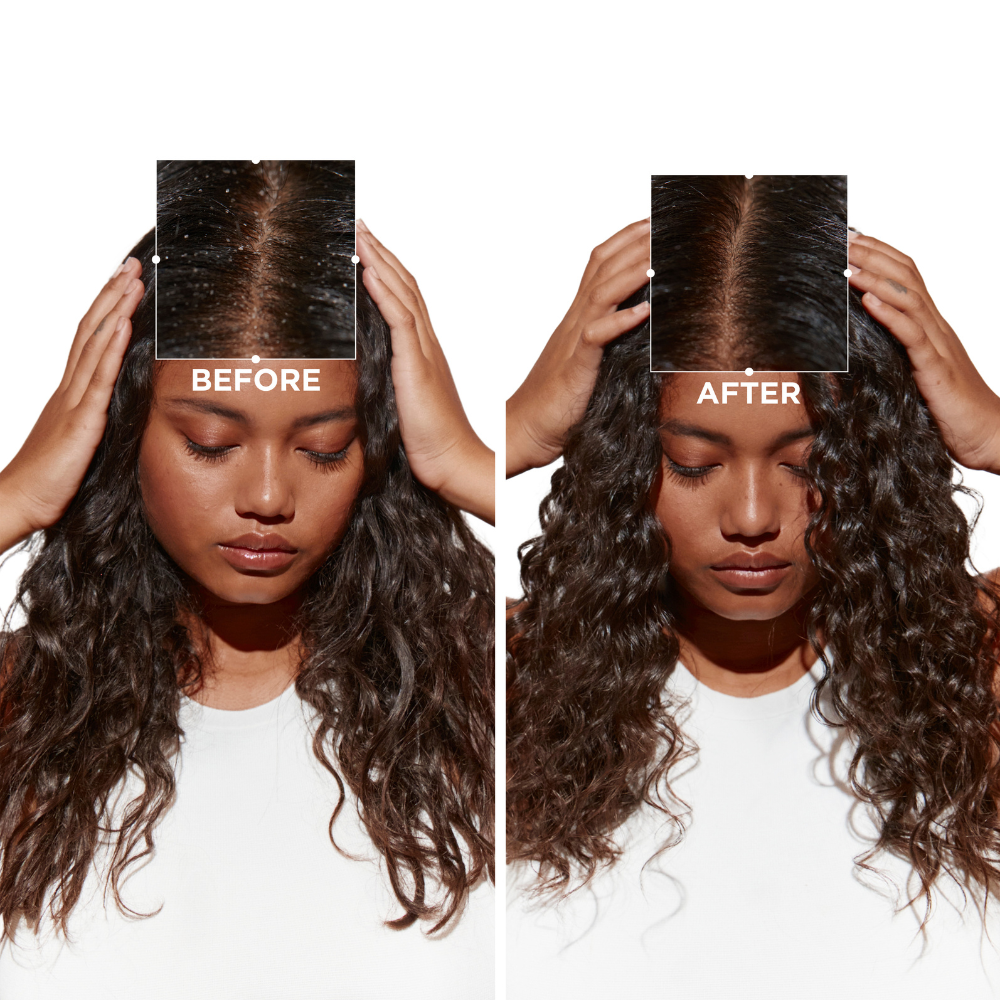 Kérastase | Shampoo Anticaspa Cabello Seco Symbiose 250ml