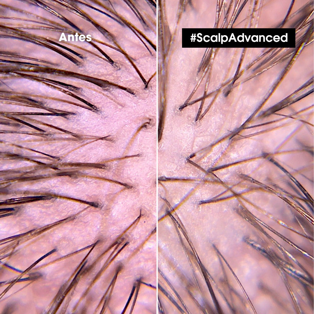 L'Oréal Professionnel | Shampoo Anti Irritación Scalp 300ml