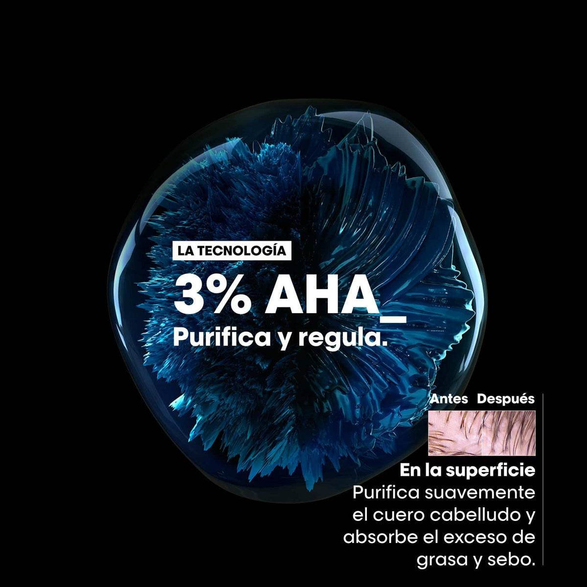 Shampoo Anti Grasa L'Oréal Professionel Scalp 300ml