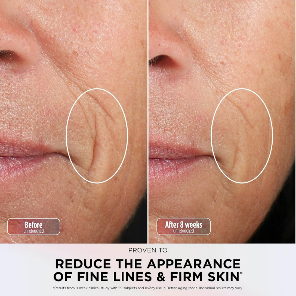 Shark  | CryoGlow - Máscara facial LED, Con Tecnología Refrescante