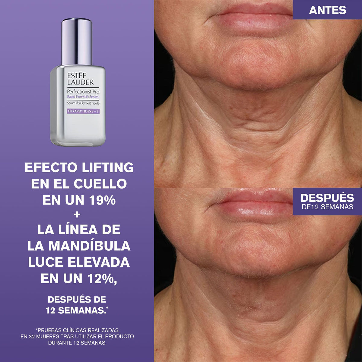 Estée Lauder | Suero Tratamiento Firmeza + Lifting Rápidos Perfectionist Pro