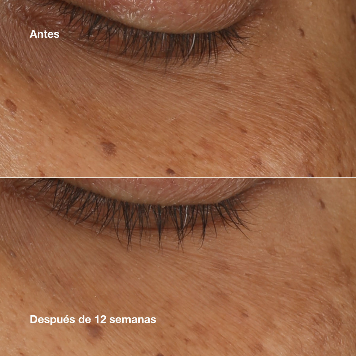 Clinique | Suero Concentrado All About Eyes™ Iluminador